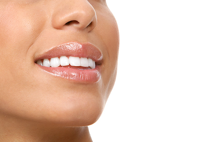 Woman with healthy teeth