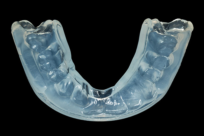 Mouthguard