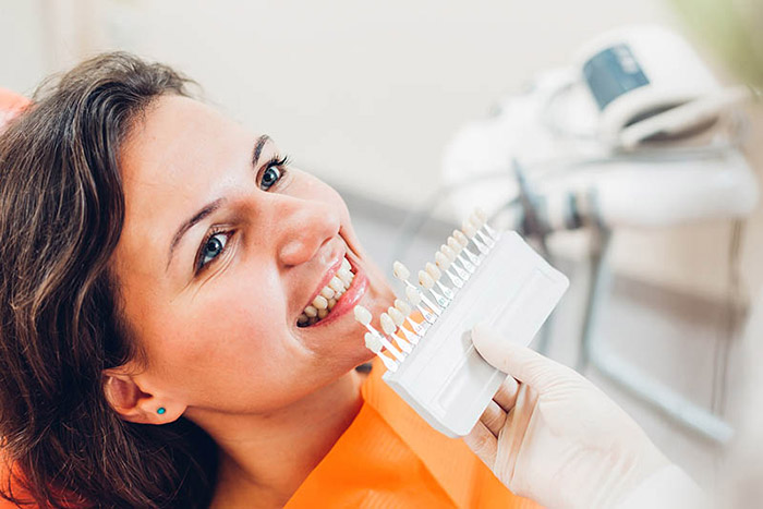 Woman with tooth color samples