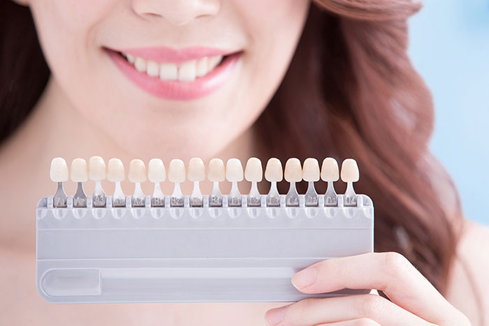 Woman holding tooth color samples