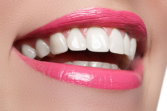 Closeup of woman smiling