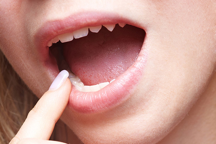 Girl pointing to her teeth